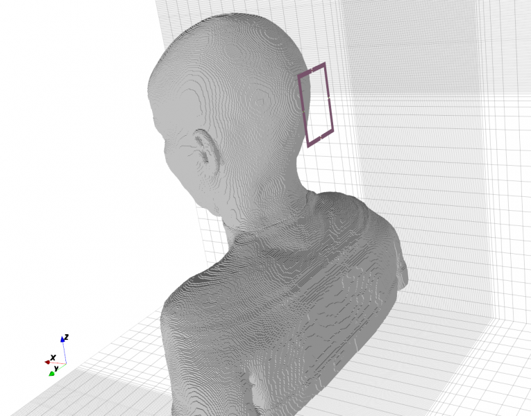 File:MRI Loop Coil Setup.png